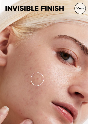 Acne Pimple Patch I Dew Care Timeout Blemish Con Aceite De Á