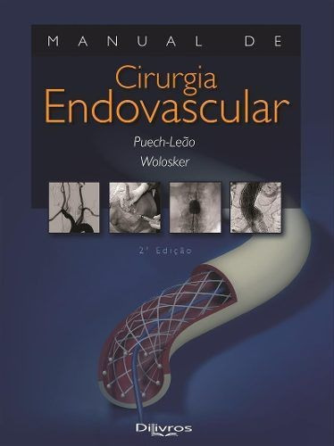 Livro Manual De Cirurgia Endovascular