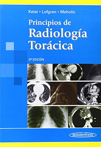 Libro Principios De Radiología Torácica De Loren H. Ketai, R