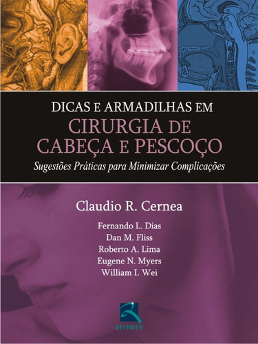 Dicas e Armadilhas em Cirurgia de Cabeça e Pescoço, de Cernea, Claudio R.. Editora Thieme Revinter Publicações Ltda, capa dura em português, 2015