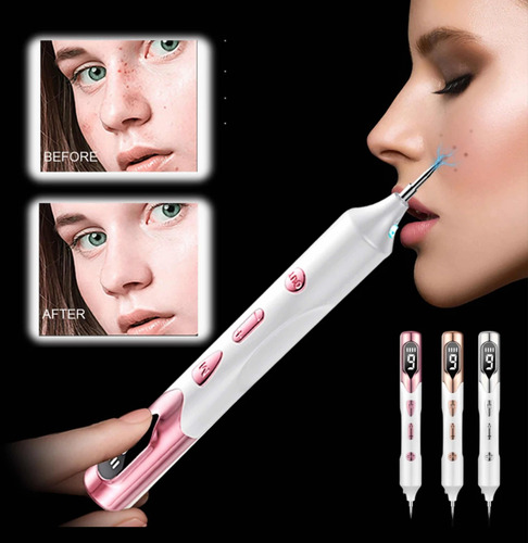 Pluma Láser Plasma Quita Manchas Piel Belleza Lápiz Verrugas
