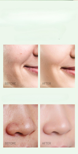 Tratamiento Facial Bálsamo Limpiador Puntos Negros