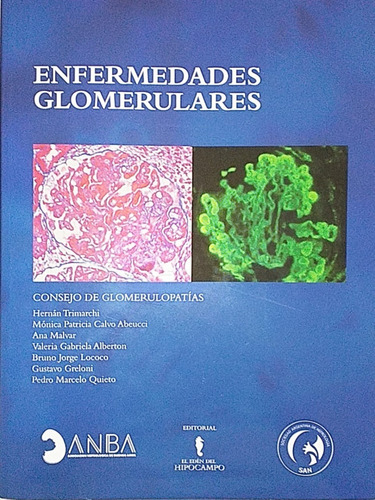 Enfermedades Glomerulares Consejo De Glomerulopatías Envíos