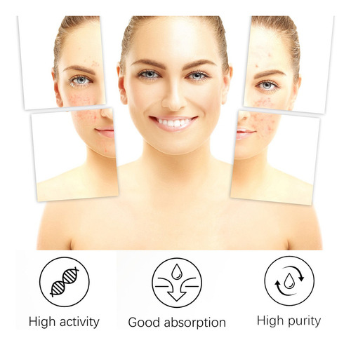 . Crema For Tratar El Acné: Combate El Acné Hormonal