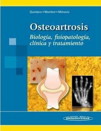 Osteoartrosis