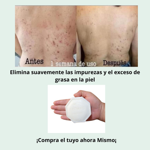 Jabon Tea Tree Farmasi Control De Acne Piel Grasa Y Mixta