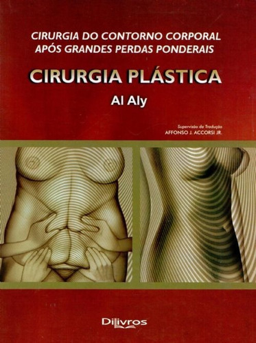 Cirurgia Do Contorno Corporal Após Grandes Perdas Ponderais - Cirurgia Plástica, De Al Aly. Editora Dilivros, Capa Dura Em Português, 2008