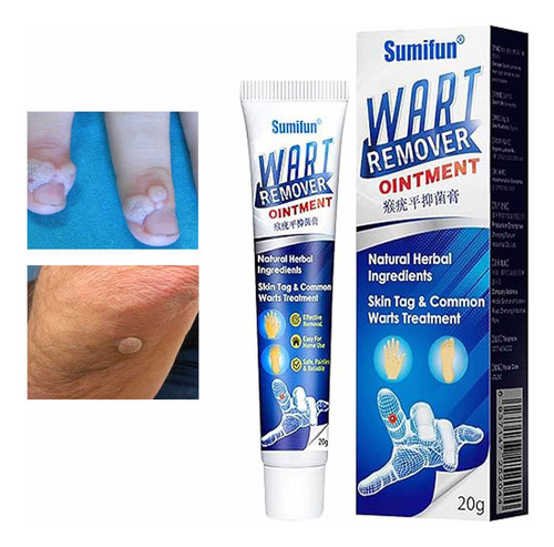 Removedor De Verrugas, Vph, Acrocordones, Tic Tec