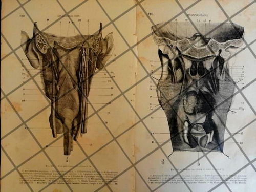 Grabado Medico Antiguo 1877 Musculos Cuello Trasero /09