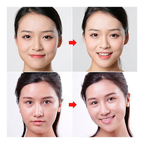 Parche De Estiramiento Facial En Forma De V Transpirable