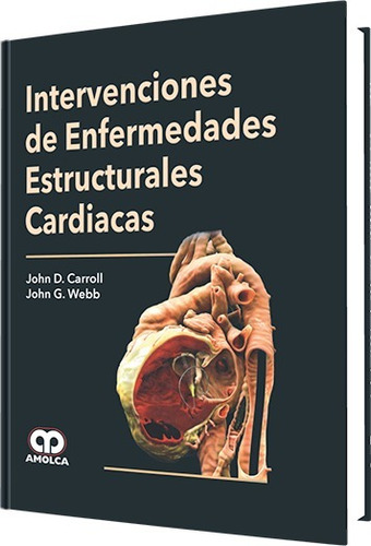 Carrol Intervenciones De Enfermedades Estructurales Cardiaca