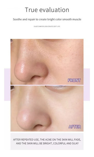 3 Pcs Blackhead And Pimple Remover Green Mask Stick