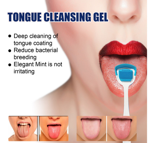 Gel Limpiador De Lengua De 2 Piezas, Kit De Cepillo De Limpi