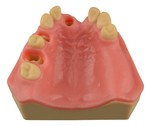Modelo Maxilar De La Práctica De Implantes Dentales Sinusale