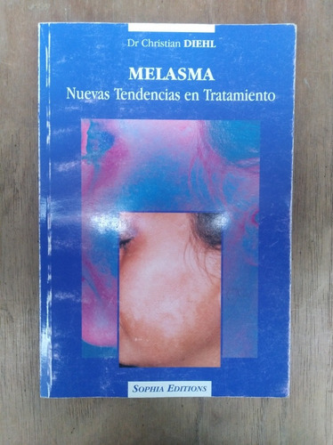 Melasma: Nuevas Tendencias En Tratamiento - Dr. C. Diehl  