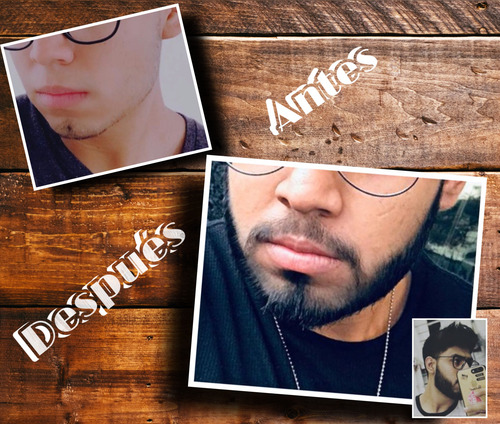 Tónico Para El Crecimiento De Barba Minoxidil