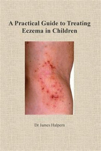 A Practical Guide To Treating Eczema In Children - Dr Jam...