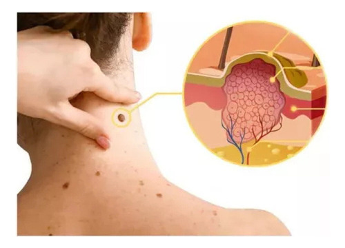 17- A 3pcs Tag Recede Bee,tag Recede Bee Spray For Mujeres Y