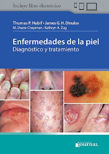 Enfermedades De La Piel Diagnostico Y Tratamiento Journal