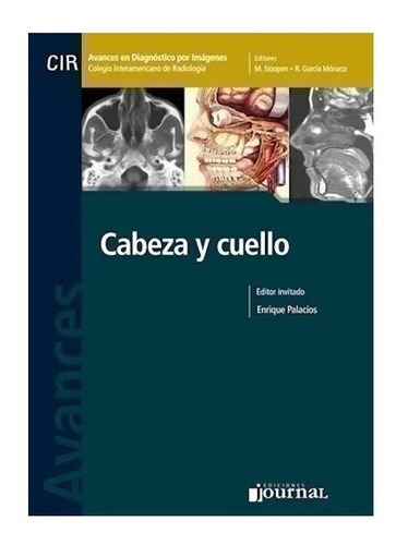 Avances En Diagnóstico Por Imágenes: Cabeza Y Cuello - Pala