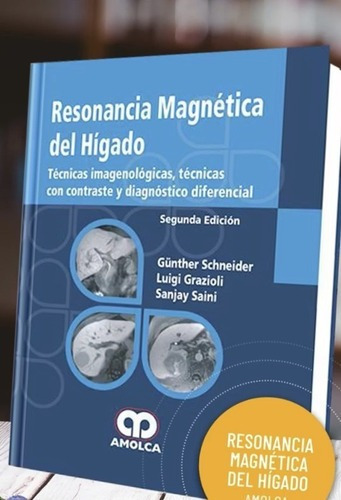 Resonancia Magntica Del Hgado 2 Da Ed,jk