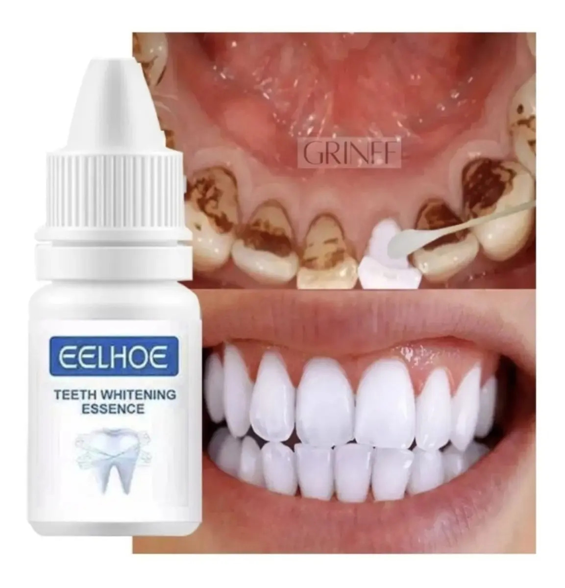 Clareador Dental Efero Whitening 10ml Antimanchas Placas