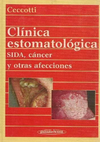Libro Clinica Estomatologica : Sida, Cancer Y Otras Afeccion