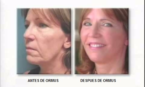 Ormus Producto Naturista De Mayoreo 3 Litros Envío Gratis