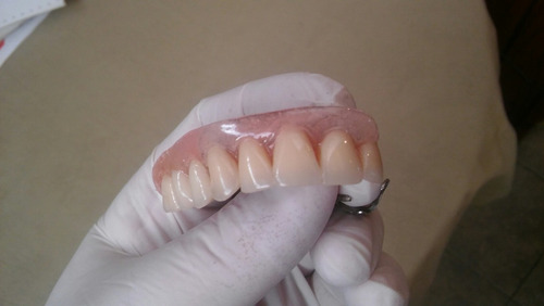 Imagen 1 de 5 de Reparamos Protesis Dentales
