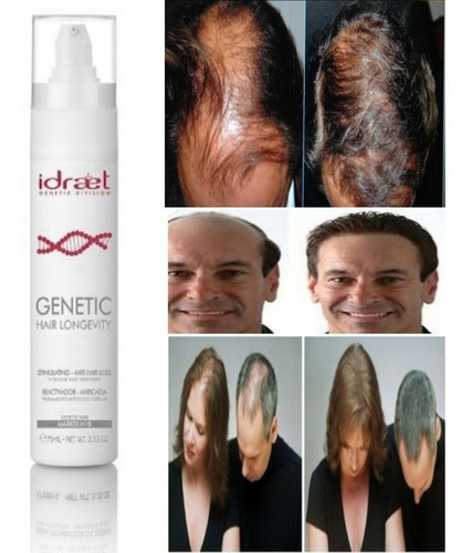Hair Loss Control Idraet Shampoo Neutro Engrosador Anticaida