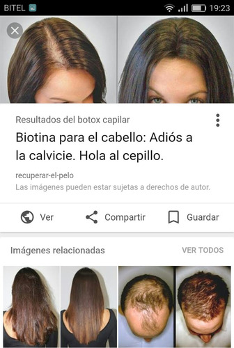 540 Puntas De Titanio Dermaroller Rohs 0,5 Sellado Original