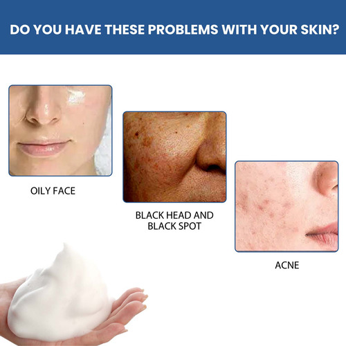 Dr. Yi Whitening Facial Cleaner Control Clareamento Facial