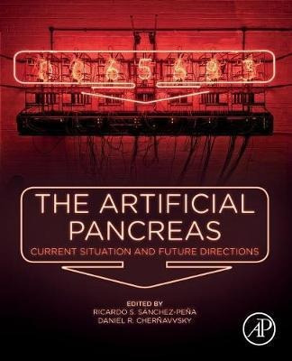 The Artificial Pancreas : Current Situation And Future Di...