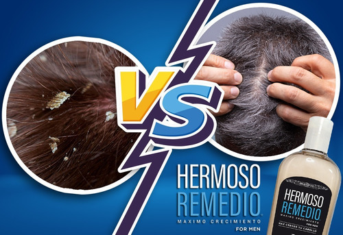 Imagen 5 de 10 de Kit Barba Y Cabello Hermoso Anticaída Crece Anticaspa Hombre