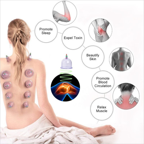 Imagen 5 de 10 de Kit 12 Ventosas Chinas Vacumterapia + Manguera Premium