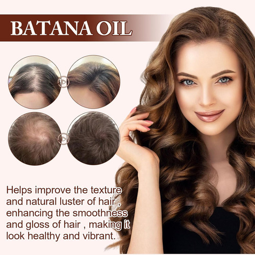 Mox Aceite Capilar Batana, Crecimiento Del Cabello, Pérdida