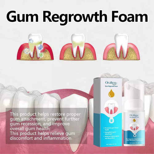 -- Espuma Para Crescimento Gengival Em Formato De V, 30 Ml