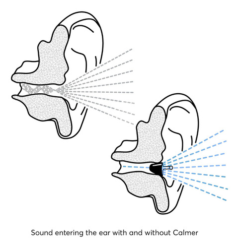 Flare Calmer ' Alternativa A Tapones Para Los Oídos ' Reduce