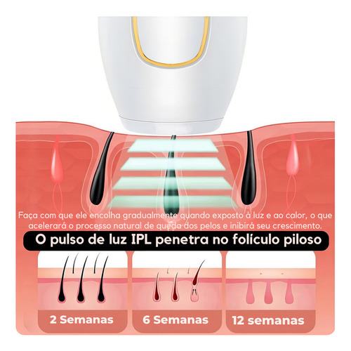 Depilador Definitiva Laser Luz Pulsada Remover Pelos Em Casa Cor Preto
