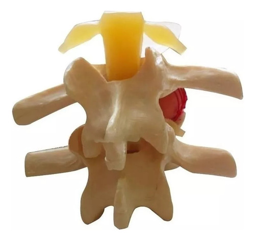 Anatomía Disco Lumbar Columna Vertebral Modelo Enseñando2024