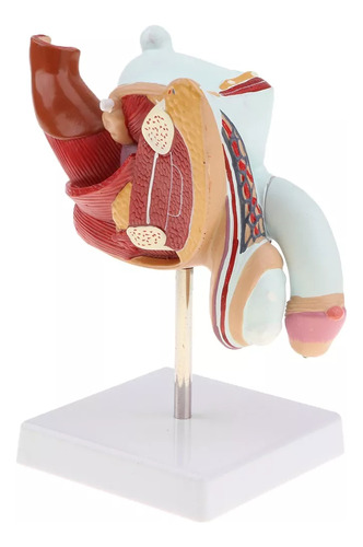 Modelo De Anatomía Patológica Del Sistema Urinario 1:1