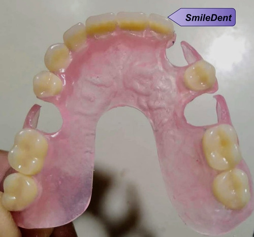 Imagen 3 de 5 de Prótesis Dentales Dentista A Domicilio,o Consul En 4 Días !!