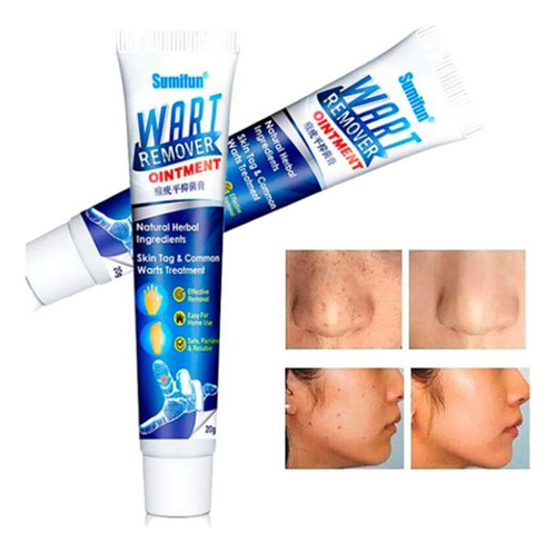 Removedor De Verrugas, Vph, 2 Unidades