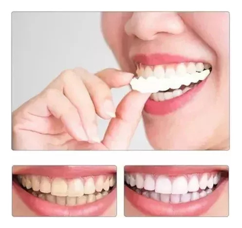 I Carillas De Dientes Postizos De Sonrisa Superior Inferior