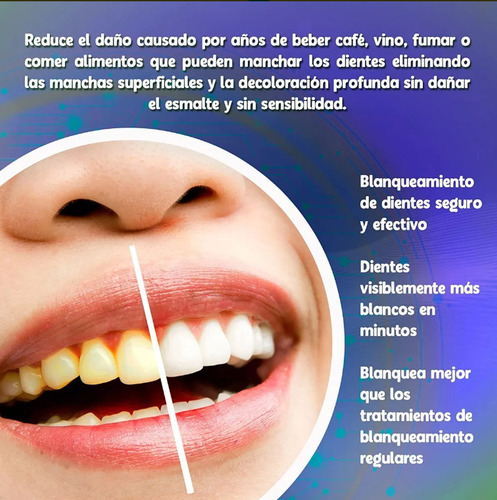 Blanqueador Dental Sin Peroxido Luz Led Y Lapiz Corrector