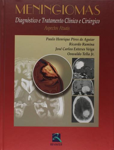 Meningiomas: Diagnóstico E Tratamento Clínico E Cirúrgico, De Paulo Henrique Pires De Aguiar. Editora Revinter, Capa Dura Em Português, 2006