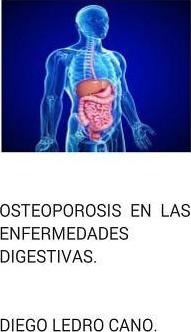 Osteoporosis En Las Enfermedades Digestivas. - Dr Diego L...