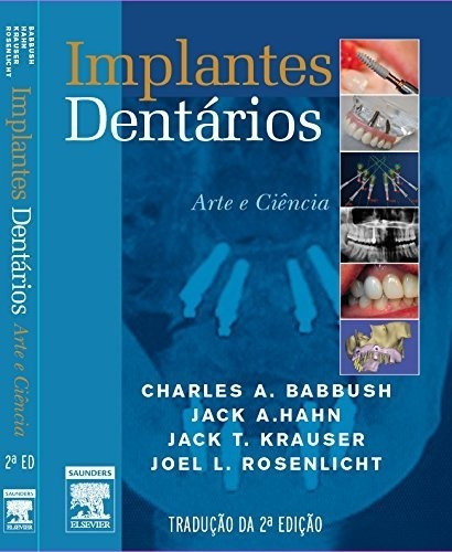 Implantes Dentários. Arte E Ciência