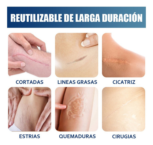 Gel De Silicona Para Eliminar Cicatrices De Cesárea Estrías Neutra