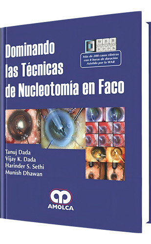 Dominando Las Técnicas De Nucleotomía En Faco. Libro Médico.